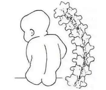 為了保護孩子的脊柱 家長們需要注意這些方面