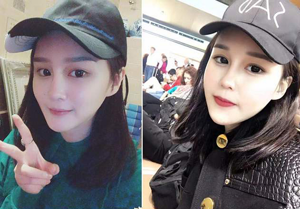 趙本山女兒撞臉李小璐？竟花30萬做鼻子！