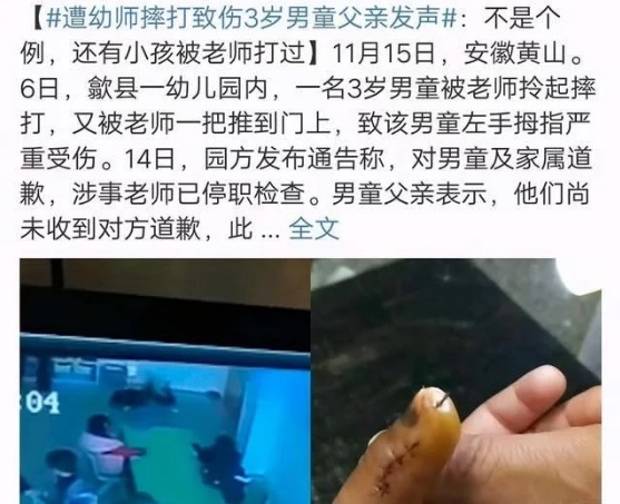 得知孩子被虐待，寶爸怒打幼師，園方袒護(hù)老師不道歉不讓報(bào)警